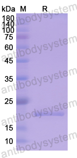 Recombinant Human SIVA1 Protein, N-His