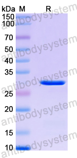 Recombinant Human PMM2 Protein, N-His