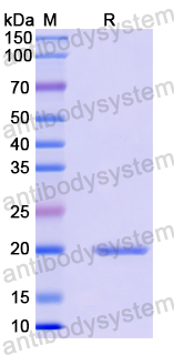 Recombinant Human SOX12 Protein, N-His-SUMO