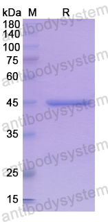 Recombinant Human HDAC3 Protein, N-His