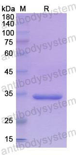 Recombinant Human BCAT2 Protein, N-His