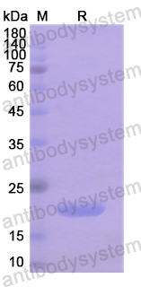 Recombinant Human BIRC5 Protein, N-His