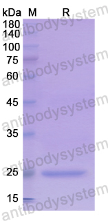 Recombinant Human TMPRSS2 Protein, N-His