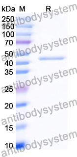 Recombinant Human TMPRSS2 Protein, N-His