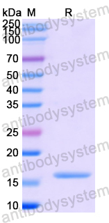 Recombinant Human CCL25/TECK Protein, N-His