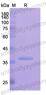 Recombinant Human P4HA2 Protein, N-His