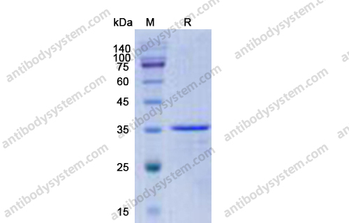 Recombinant Human CCL16/HCC-4 Protein, N-GST