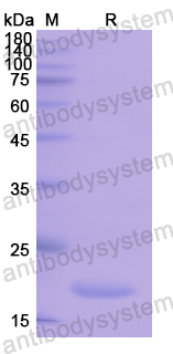 Recombinant Human PLA2G10 Protein, N-His