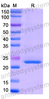 Recombinant Human INSIG1 Protein, N-His-SUMO & C-Strep