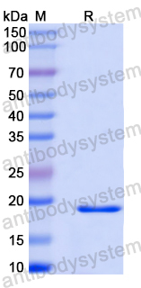 Recombinant Human FGF10 Protein, N-His