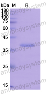 Recombinant Human OGG1 Protein, N-His