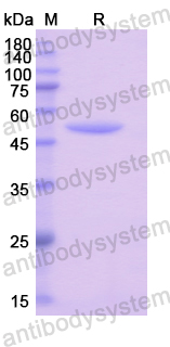 Recombinant Human RS1 Protein, N-GST