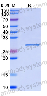 Recombinant Human DHX15 Protein, N-His