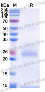 Recombinant Human CYP26A1 Protein, N-His