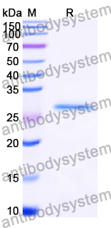 Recombinant Human CYP26A1 Protein, N-His-SUMO