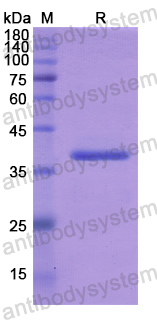 Recombinant Human ADAM12 Protein, N-His