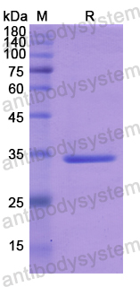 Recombinant Human IRAK2 Protein, N-His