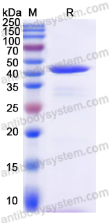 Recombinant Human PSMD3 Protein, N-His