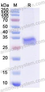 Recombinant Human SIAH2 Protein, N-His