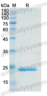 Recombinant Human TREH Protein, N-His