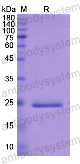 Recombinant Human ADCY6 Protein, N-His