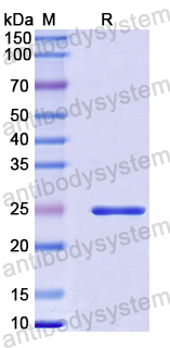 Recombinant Human ADCY6 Protein, N-His