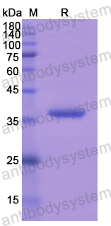 Recombinant Human FGF16 Protein, N-His-SUMO