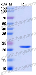 Recombinant Human FGF16 Protein, N-His