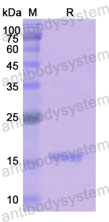 Recombinant Human DHH Protein, N-His