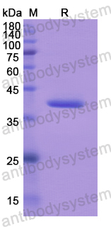Recombinant Human RIPK2 Protein, N-GST