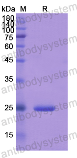 Recombinant Human FIBP Protein, N-His