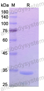 Recombinant Human SUV39H1 Protein, N-His