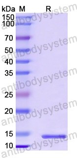Recombinant Human OIP5 Protein, N-His
