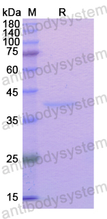 Recombinant Human TGOLN2 Protein, N-His