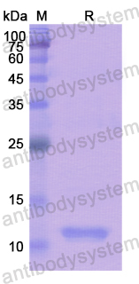 Recombinant Human LAMTOR5 Protein, N-His