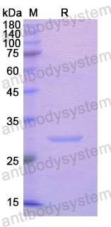 Recombinant Human ADAM20 Protein, N-His