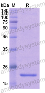 Recombinant Human WIPF1 Protein, N-His