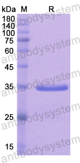 Recombinant Human FOXO3 Protein, N-His