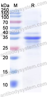 Recombinant Human SMAD6 Protein, N-His