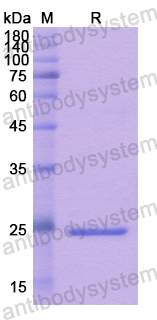 Recombinant Human LAT Protein, N-His