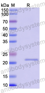 Recombinant Human DENR Protein, N-His-SUMO