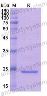 Recombinant Human SPRY2 Protein, N-His