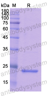 Recombinant Human SPRY1 Protein, N-His