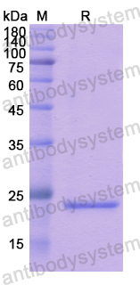 Recombinant Human SPRY3 Protein, N-His