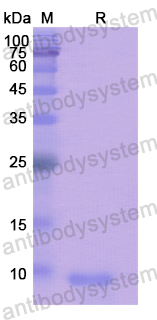 Recombinant Human HCRT Protein, N-His