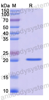 Recombinant Human TRAPPC3 Protein, N-His