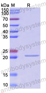 Recombinant Human CHMP2A Protein, N-His