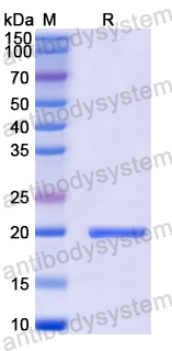 Recombinant Human BUB1 Protein, N-His