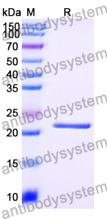 Recombinant Human AKAP7 Protein, N-His-SUMO