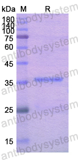 Recombinant Human ACTN4 Protein, N-His